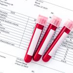 Health vials filled with blood for blood tests