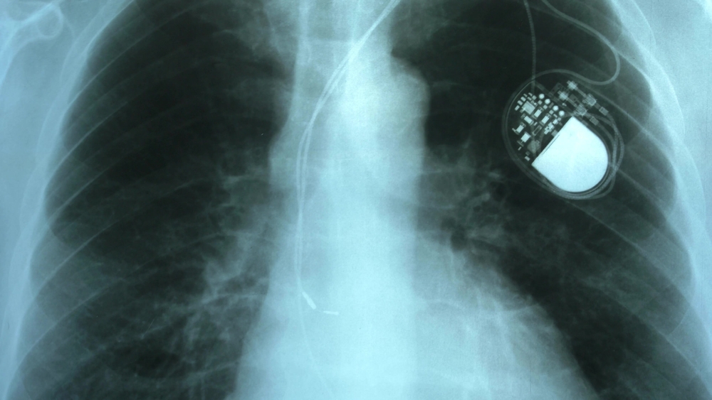 Some Medical Devices Have Been Recalled Without Any Public Warning